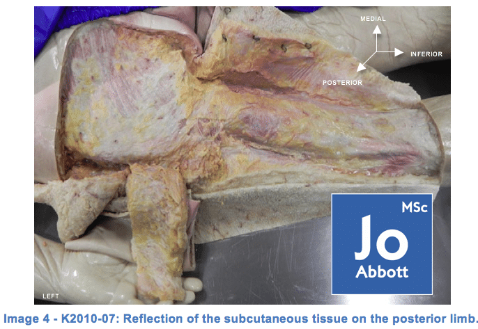 joabbottmsc dissection